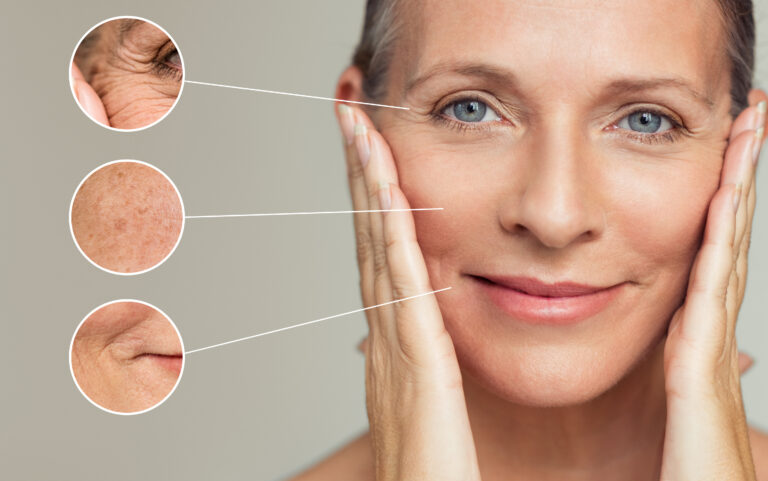 Aging Skin Graphic